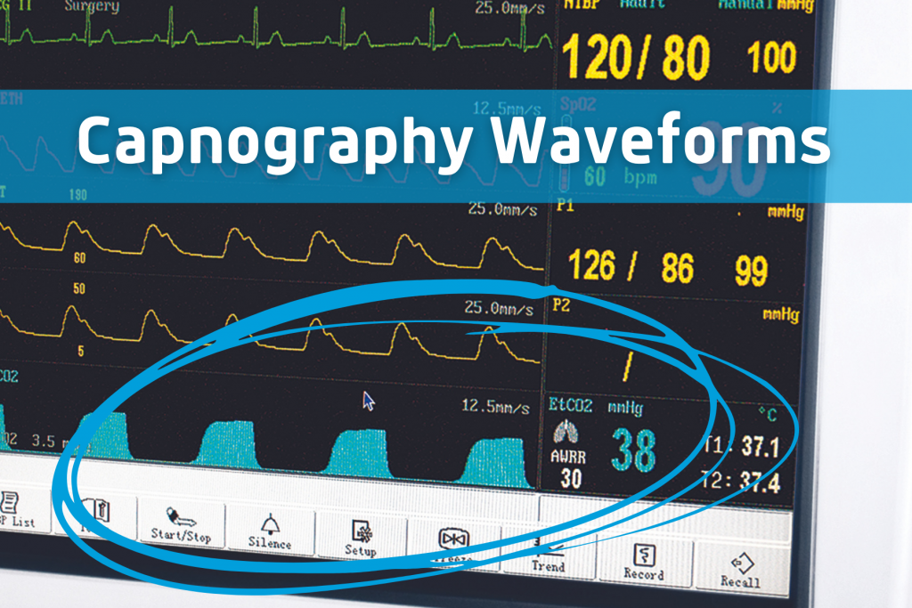 How to Read A Vital Signs Monitor 