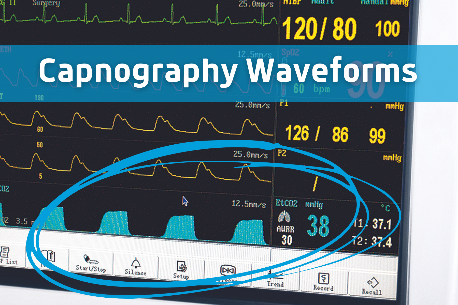How to Read and Interpret Capnography Waveforms picture image