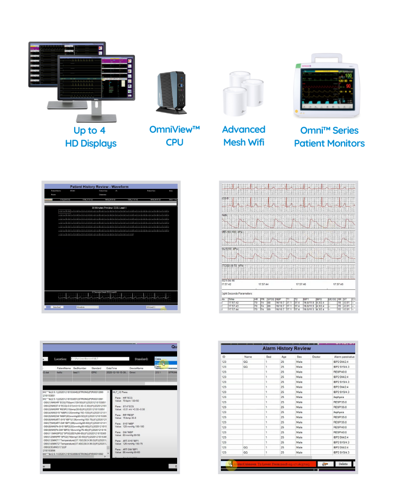 OmniView™ Vital Signs Central Station Monitoring