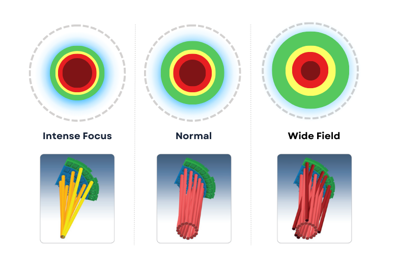 Illustration explaining how surgical lights maintain high intensity at different focus widths