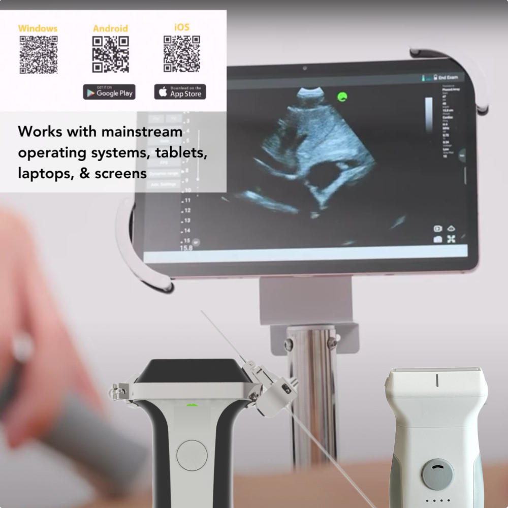 VioScan L2 - Wireless Handheld Linear Ultrasound